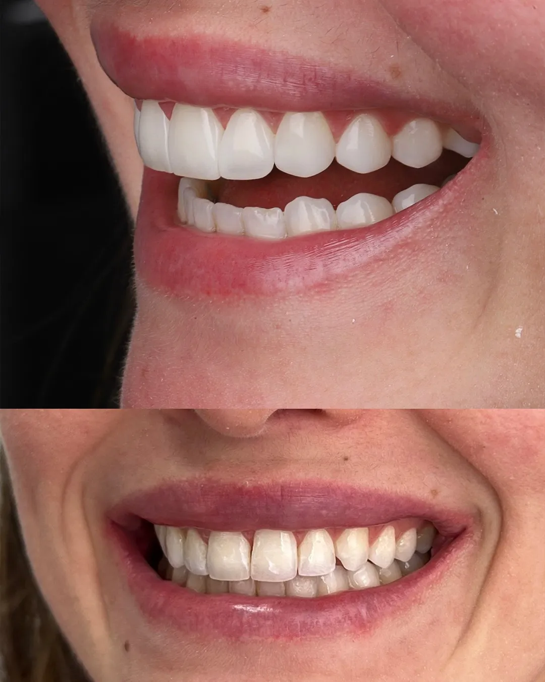 Dr Dimigueli Odontologia Resultados 01