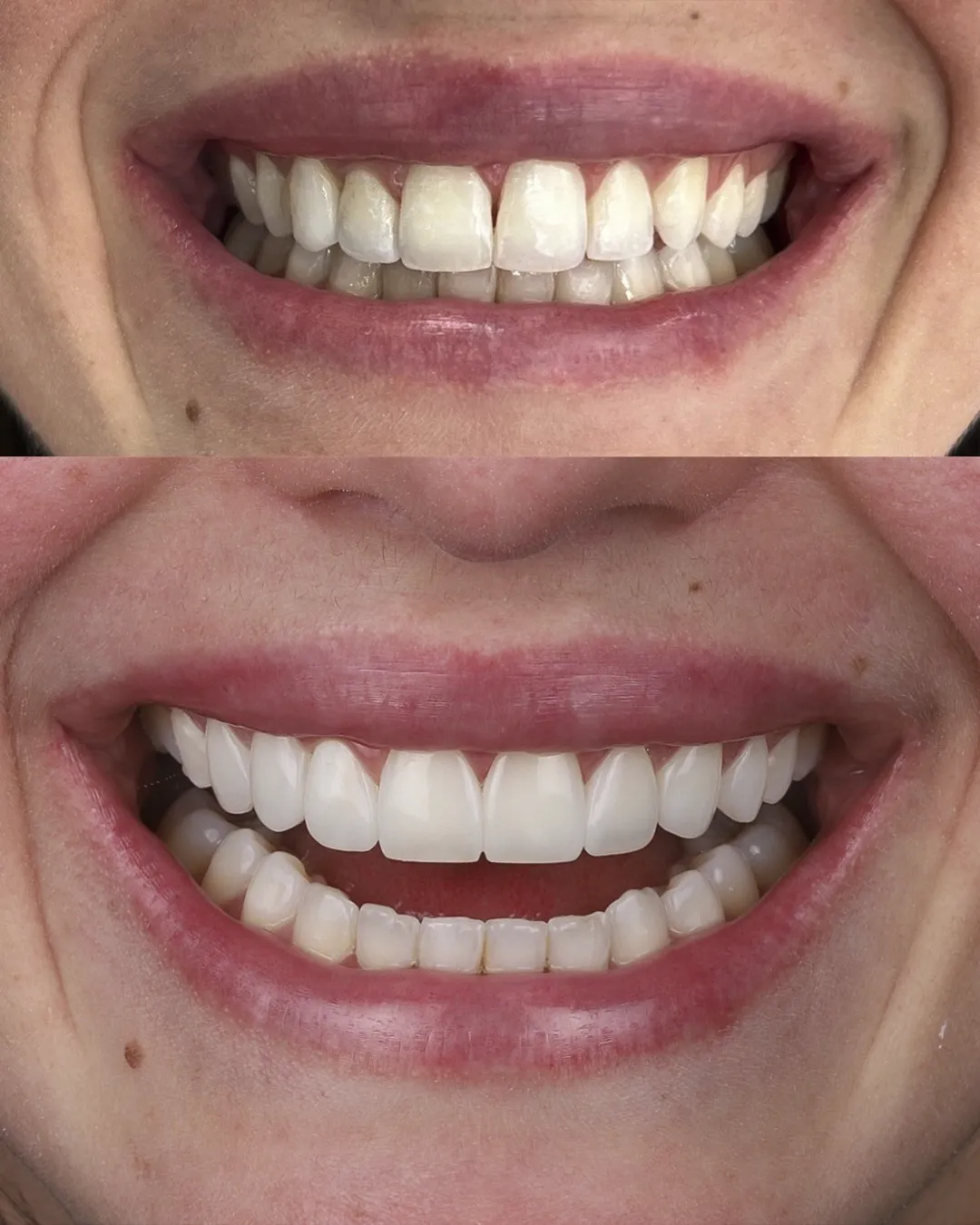 Dr Dimigueli Odontologia Resultados 02