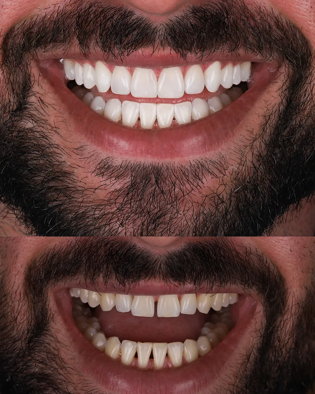 Dr Dimigueli Odontologia Resultados 03