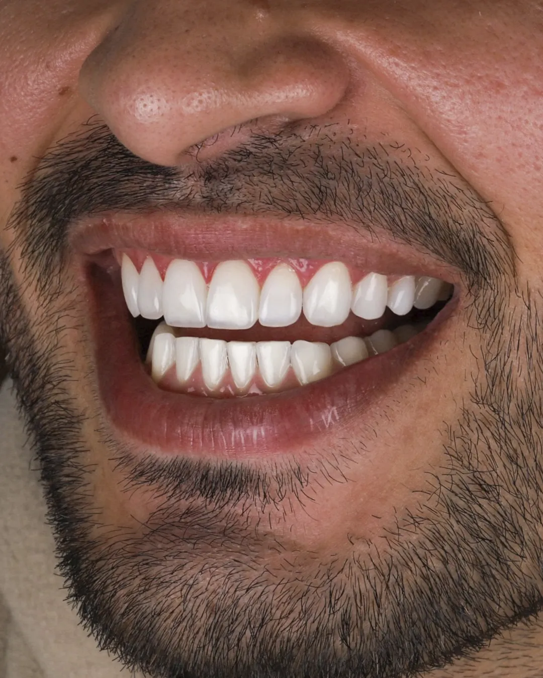 Dr Dimigueli Odontologia Resultados 04