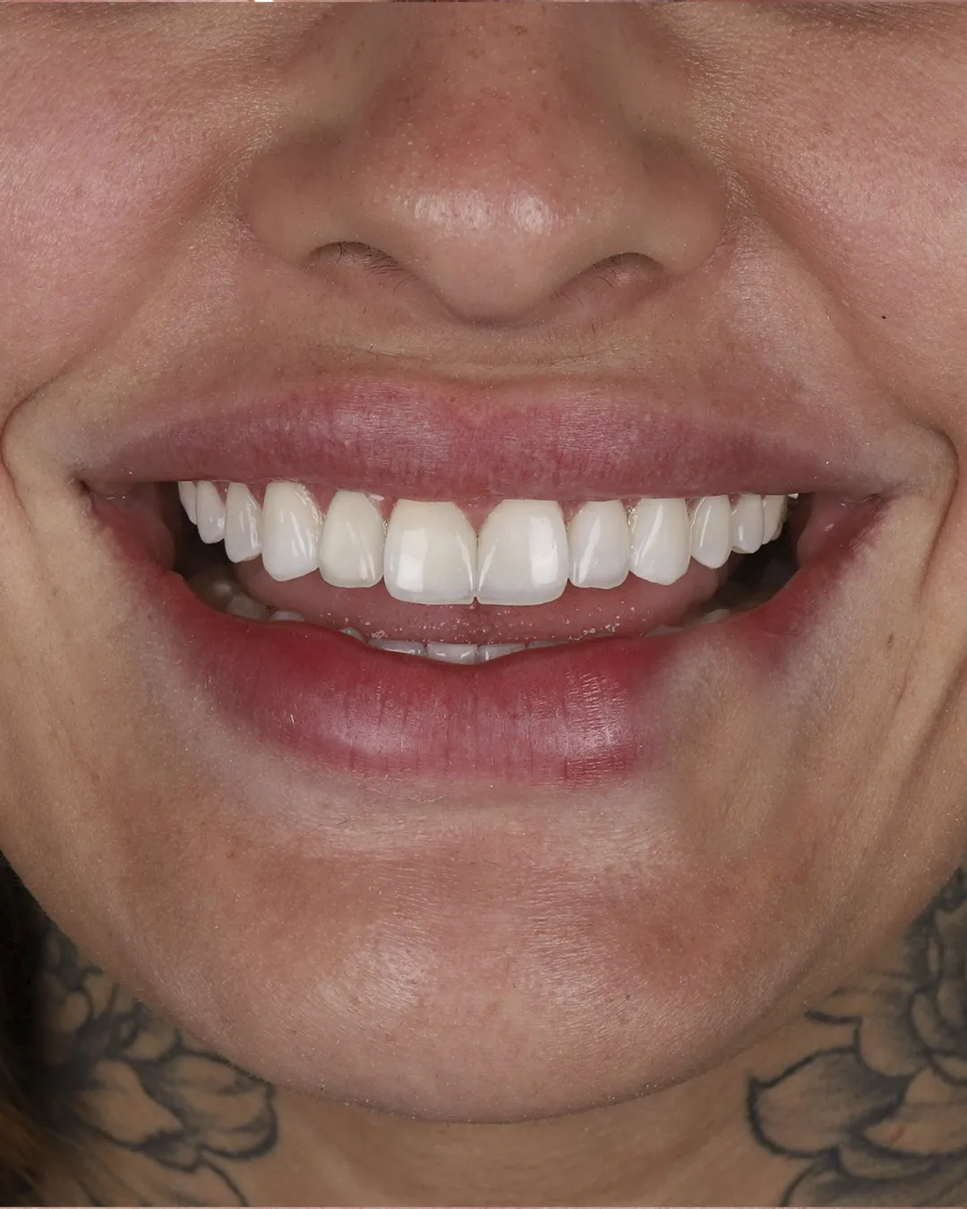 Dr Dimigueli Odontologia Resultados 05