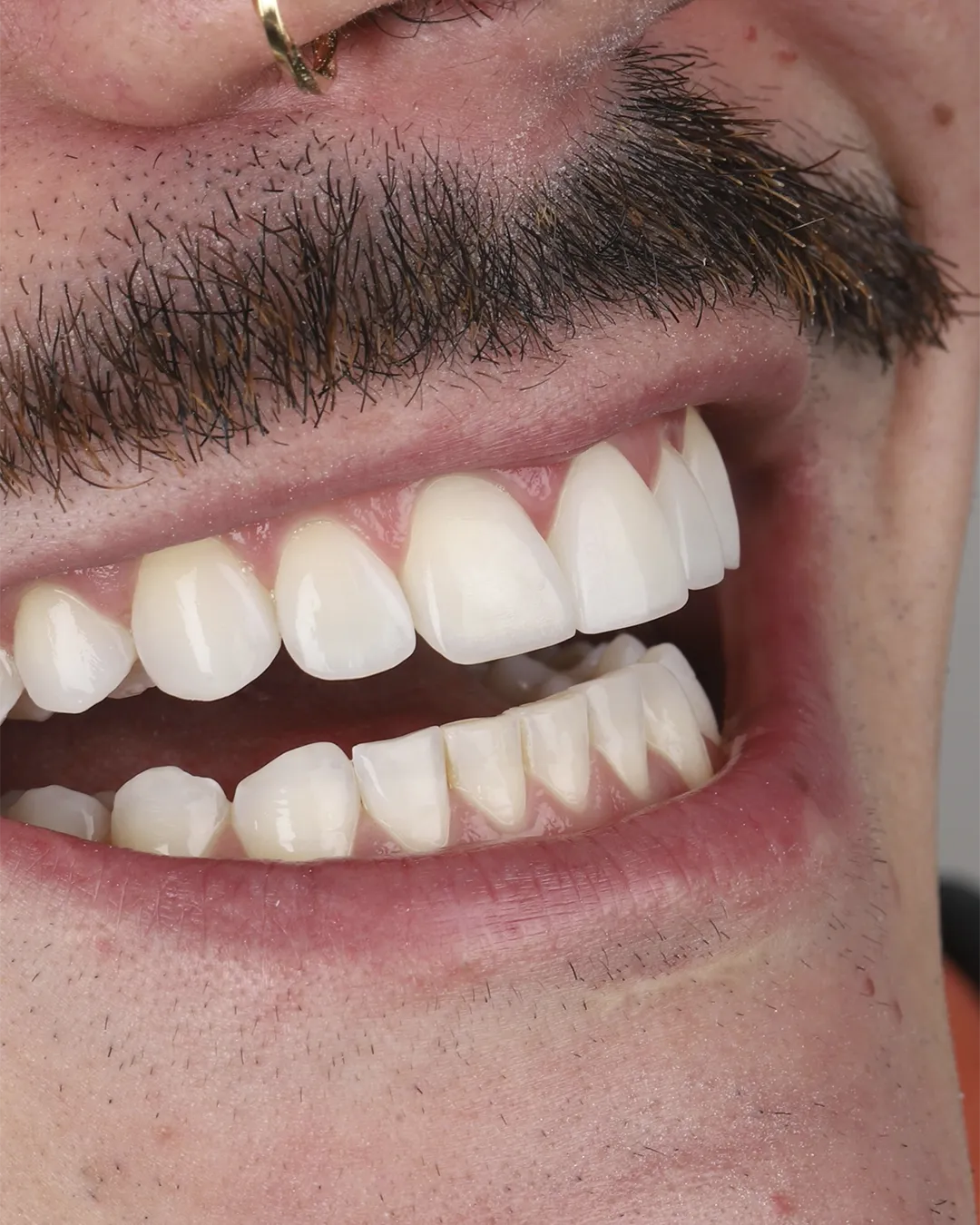 Dr Dimigueli Odontologia Resultados 06