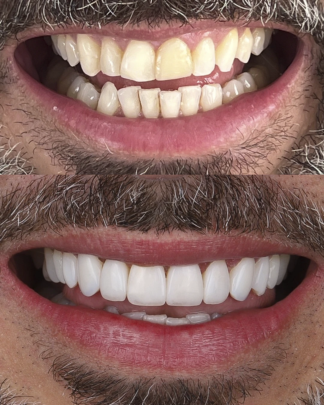 Dr Dimigueli Odontologia Resultados 07