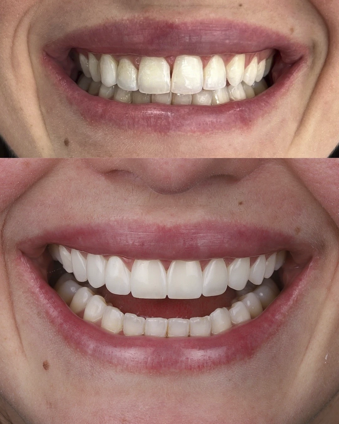 Dr Dimigueli Odontologia Resultados 08