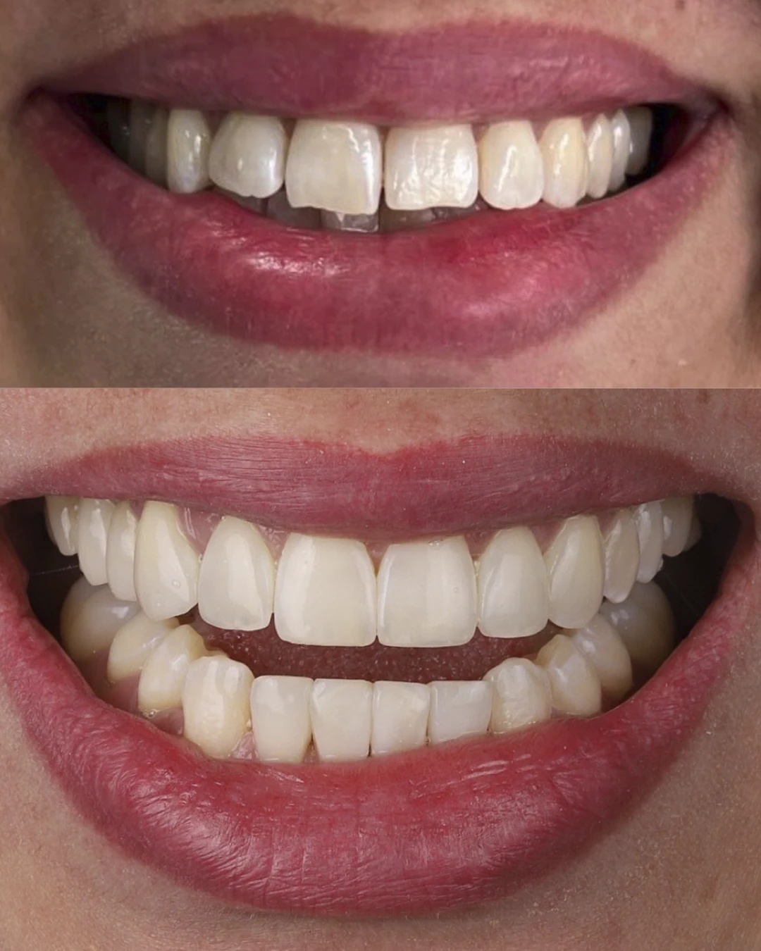 Dr Dimigueli Odontologia Resultados 09