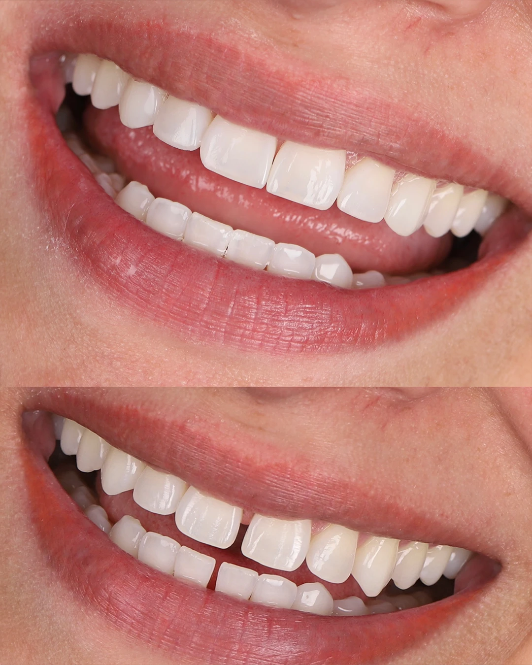 Dr Dimigueli Odontologia Resultados 10